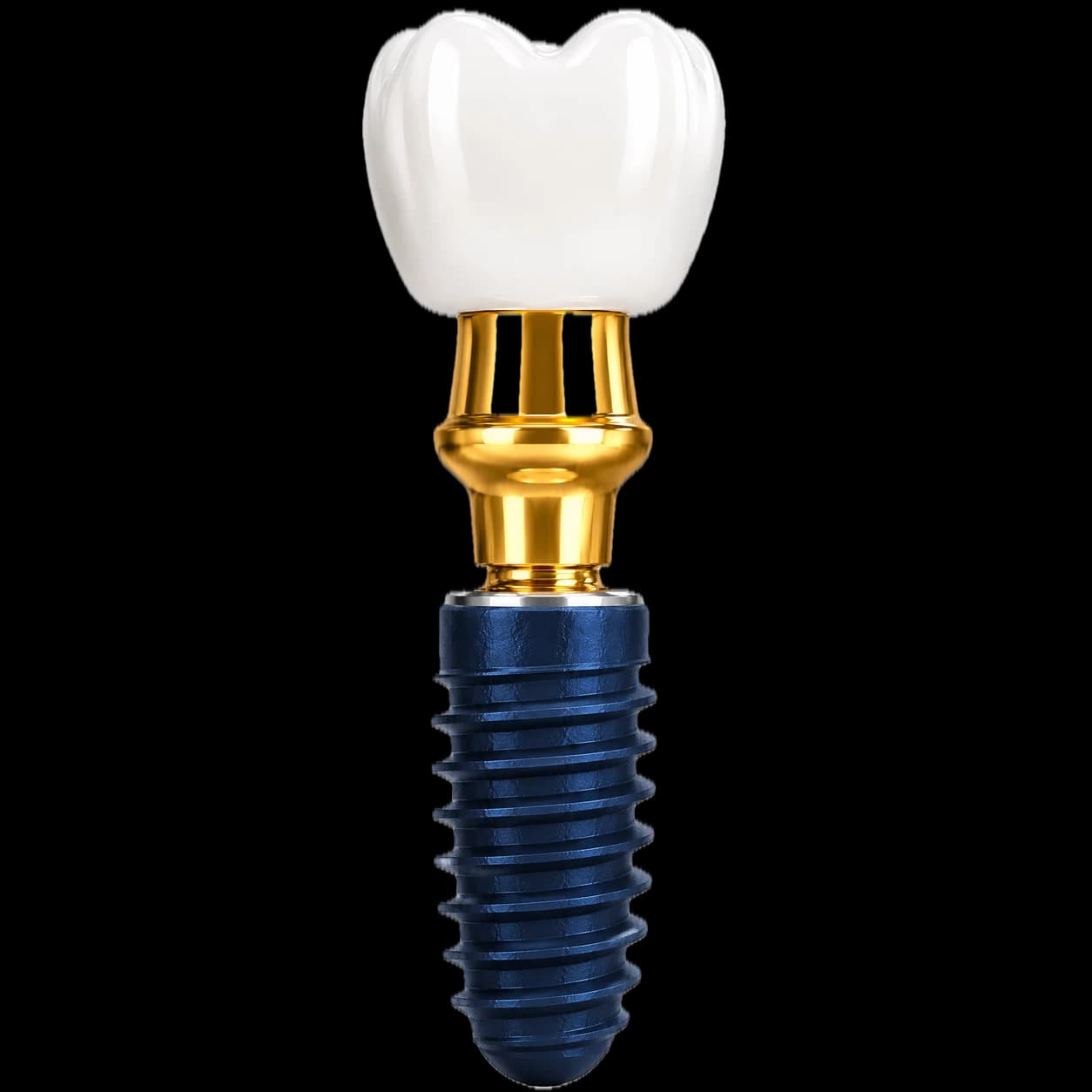 Implant dentar cu bont și coroană