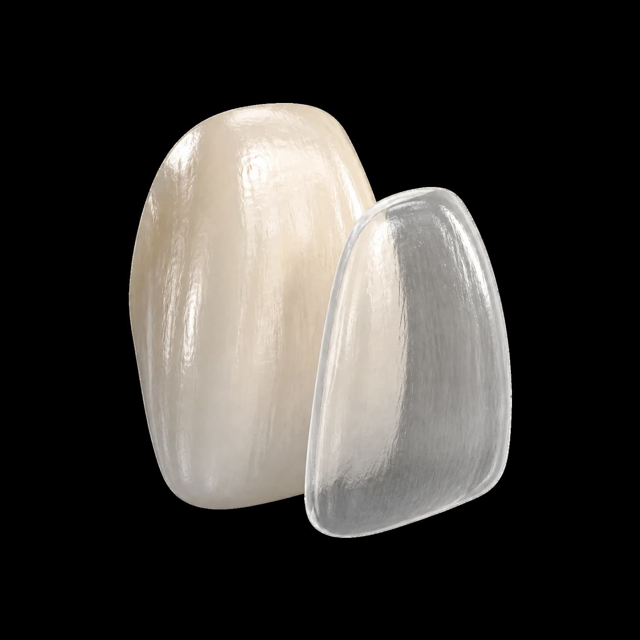 Fațetă ceramică foarte subțire, așezată pe un dinte nepregătit
